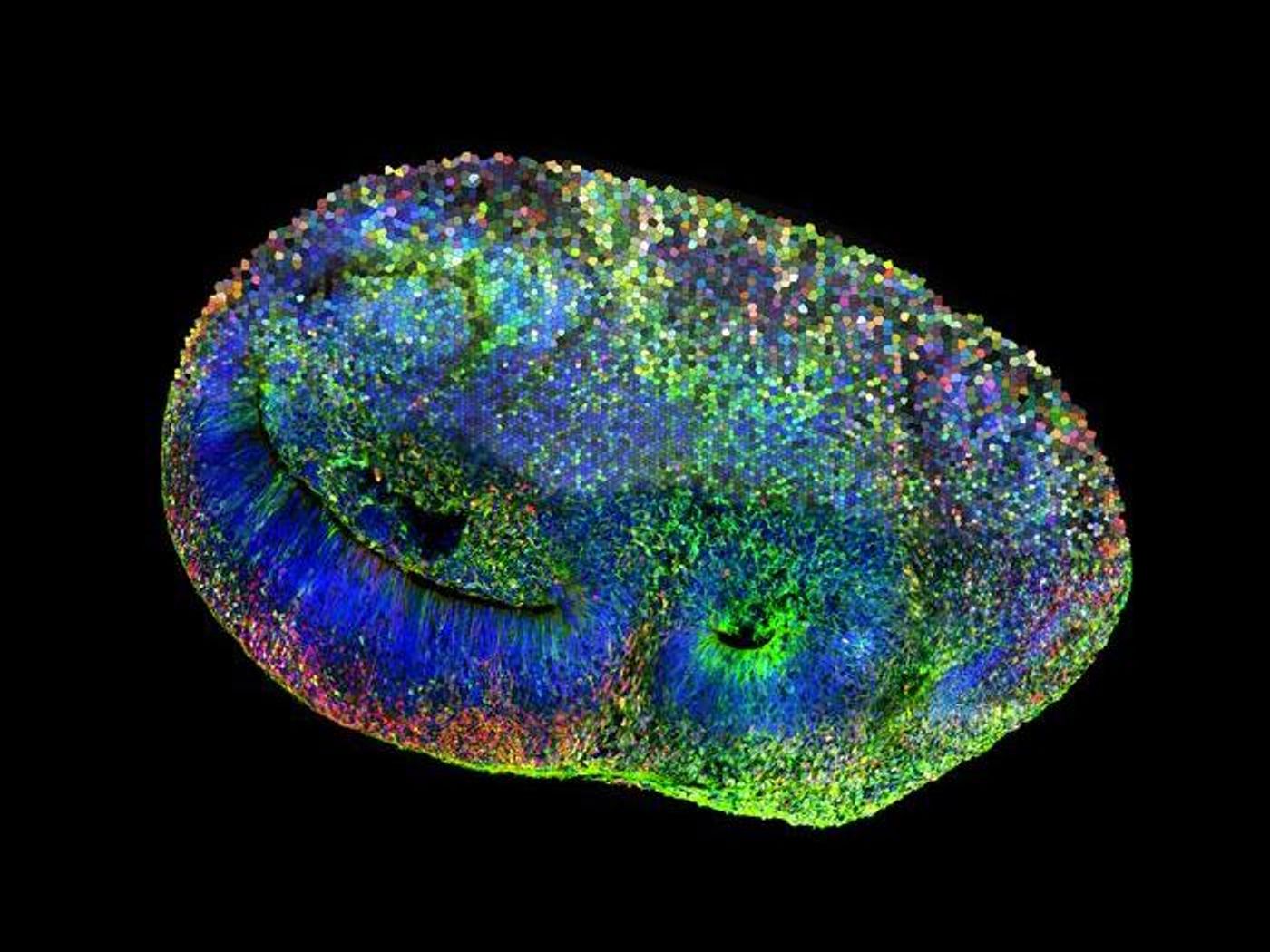 Bottom half: Confocal image of a CHOOSE (CRISPR-human organoids-scRNA-seq) human brain organoid mosaic system - cells carrying a mutation are red. Top half: a mosaic depiction of different colors representing single cells, each carrying a mutation in one high-confidence autism gene. / Credit: ©Knoblich Lab / IMBA-IMP Graphics
