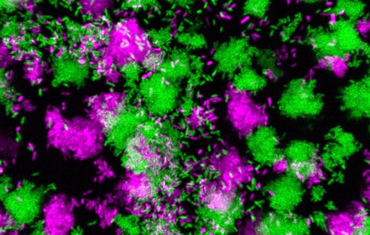 Pseudomonas aeruginosa clumps grown in synthetic cystic fibrosis sputum. / Credit: Georgia Institute of Technology