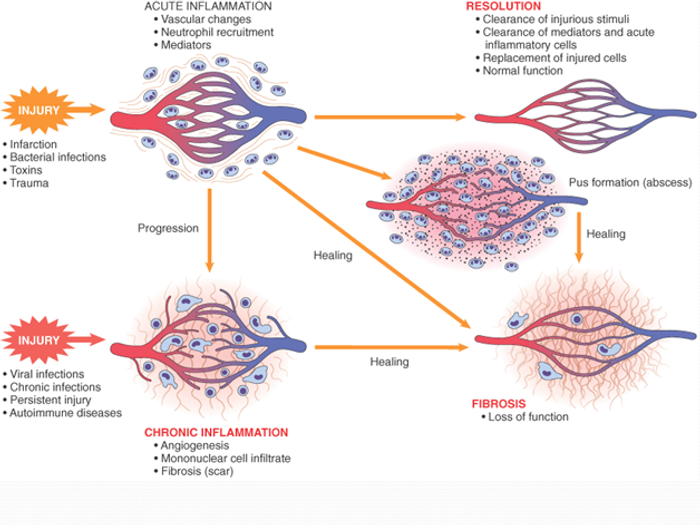 new research on inflammation