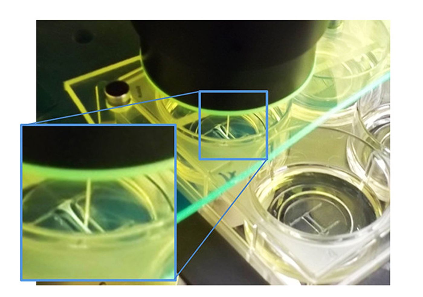 I-Wire device with cardiac fiber shown in magnification window. (Credit: VIIBRE/Vanderbilt)