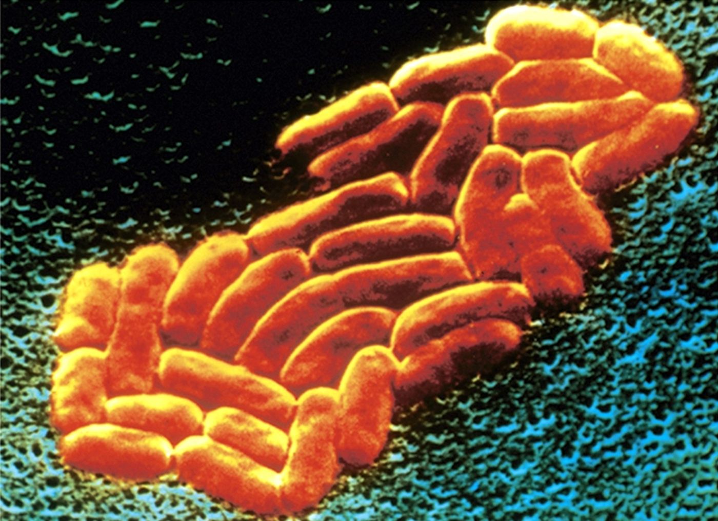 K. pneumoniae causes hospital-acquired infections.