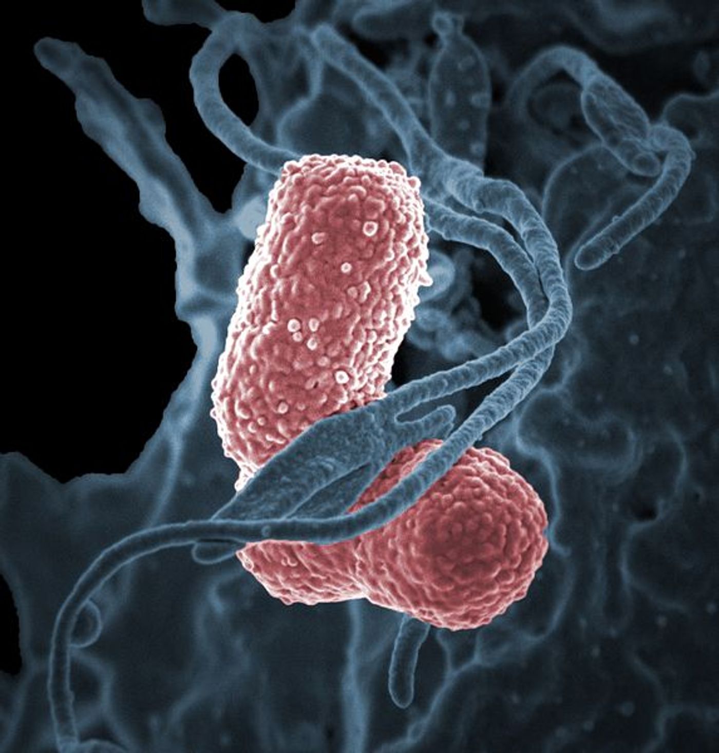 A human neutrophil interacting with Klebsiella pneumoniae (pink), a multidrug-resistant bacterium that causes severe hospital infections. / Credit: NIAID