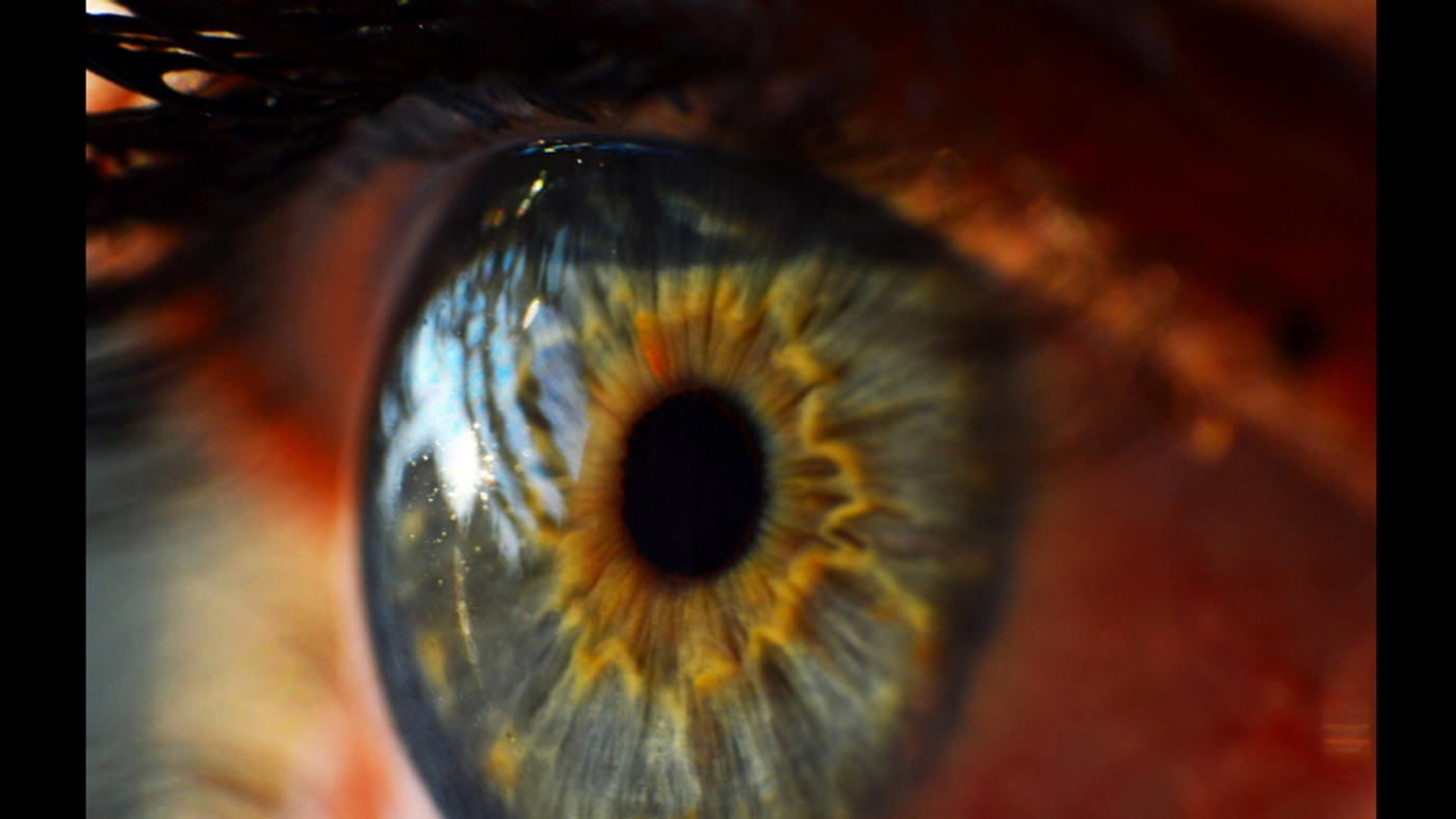 The human eye (Getty Images)