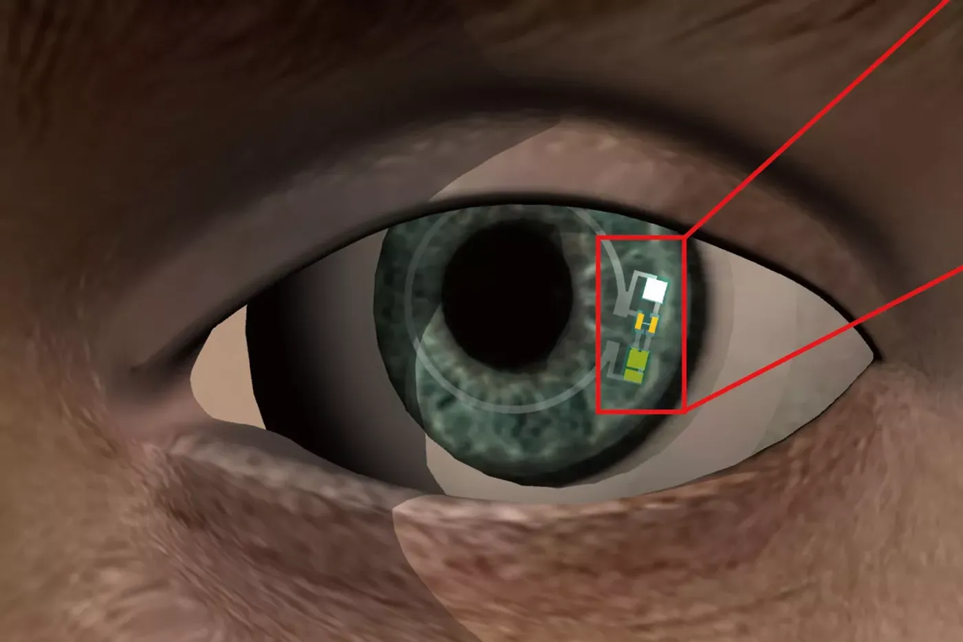 illustration of the glucose measuring lens, credit: UNIST