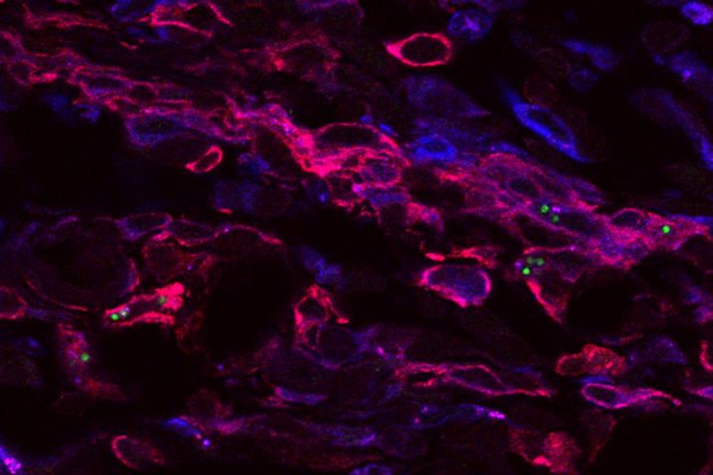 The parasite (shown in green) is constantly multiplying and being killed by immune cells (pink and blue), keeping the immune system alert. Credit: M. Mandell, S. Beverly