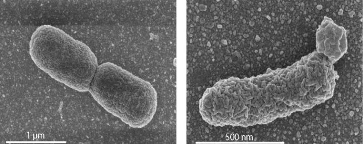 In the left panel: EM image of a normal dividing E. coli cell. Right panel: an engineered cell with high archaeal lipid production, showing lobular irregularities in the cell membrane. / Credit: Photo's University of Wageningen / Van der Oost laboratory