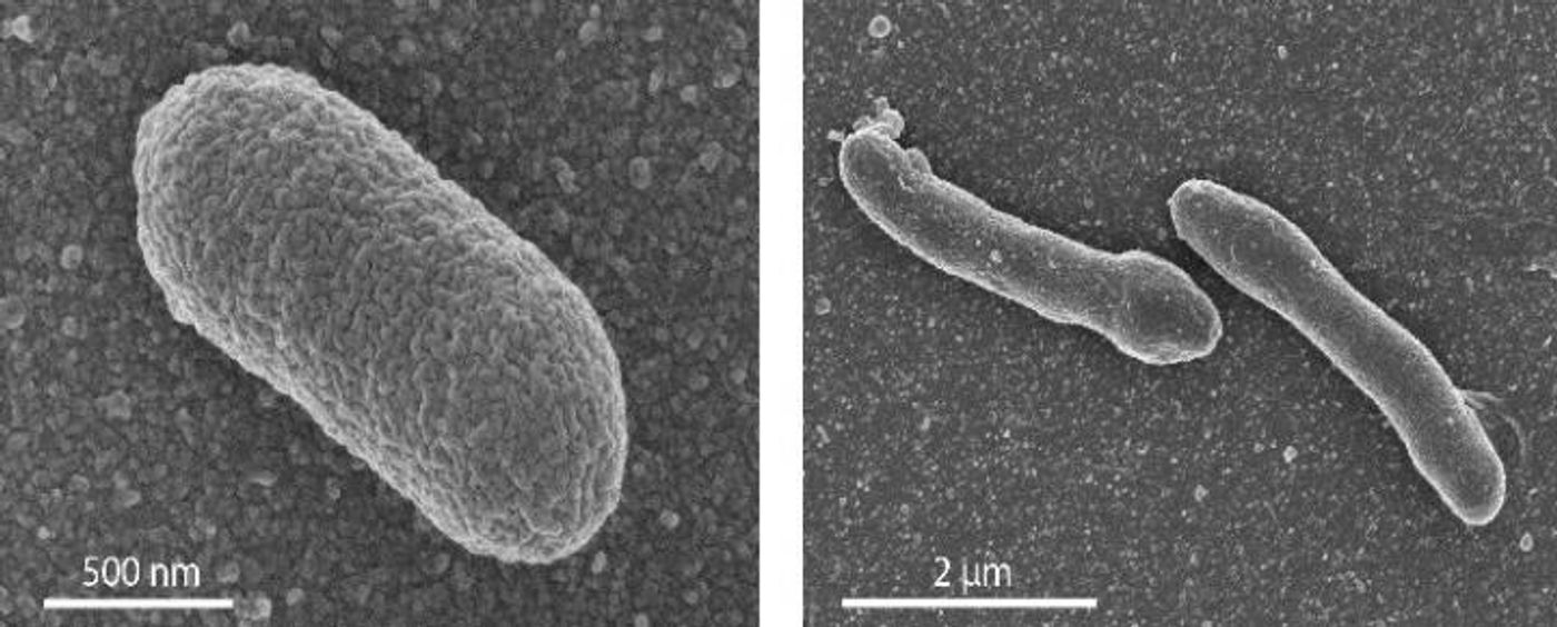 The left panel shows: EM image of a normal E. coli cell. Right panel: an engineered cell with a mixed membrane, which shows an elongated form. / Credit: Photo's University of Wageningen / Van der Oost laboratory