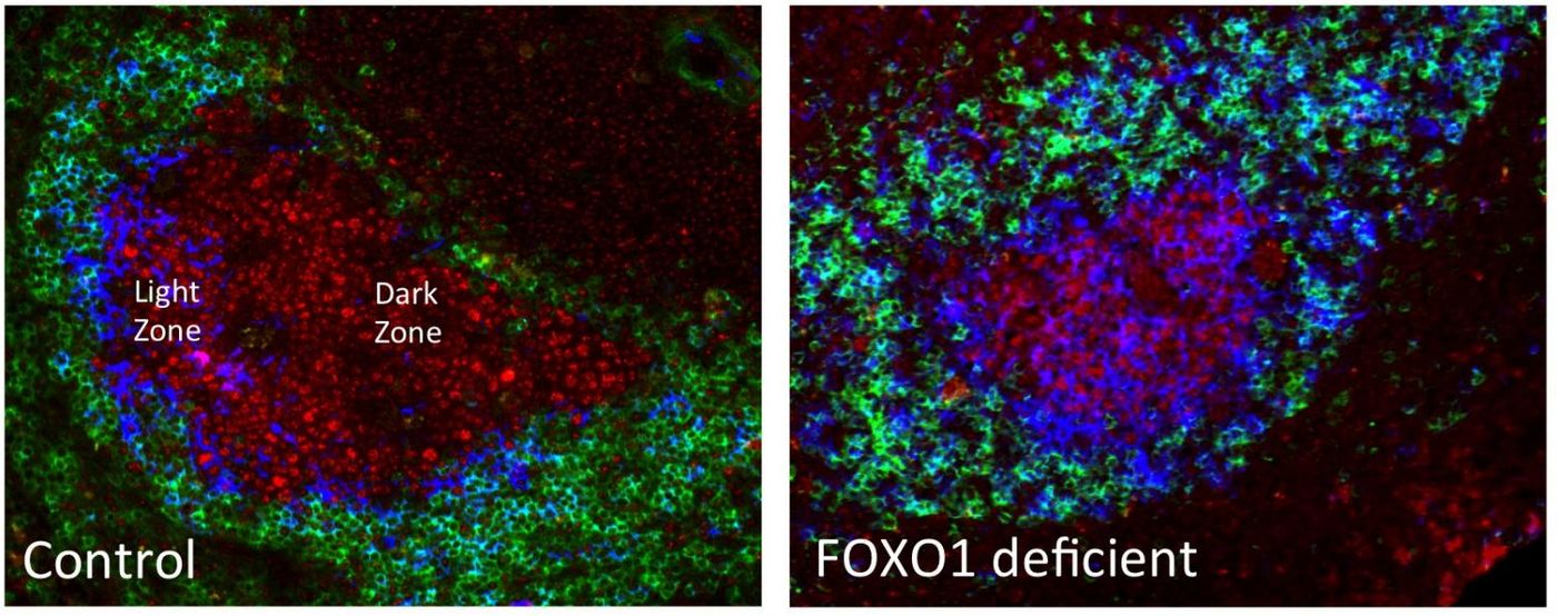 Typical interactions of the germinal center (left) versus abnormal germinal center formation in FOXO1-deficient mice