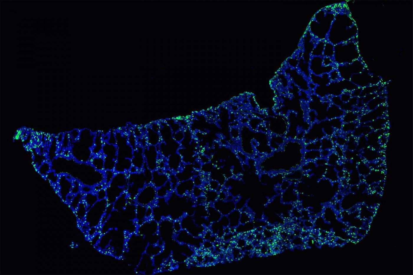 Fluorescent staining of IL-33 in a newborn mouse lung. Source: Seth Scanlon / MRC Laboratory of Molecular Biology, Cambridge