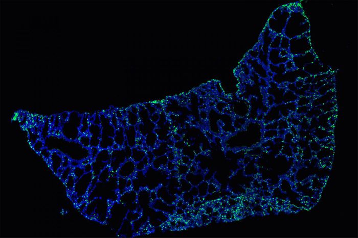 Fluorescent staining of IL-33 in a newborn mouse lung. Source: Seth Scanlon / MRC Laboratory of Molecular Biology, Cambridge