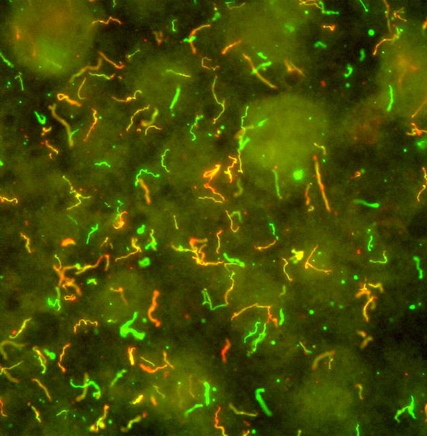 Lyme Disease Bacteria, Borrelia burgdorferi / Credit: NIAID 