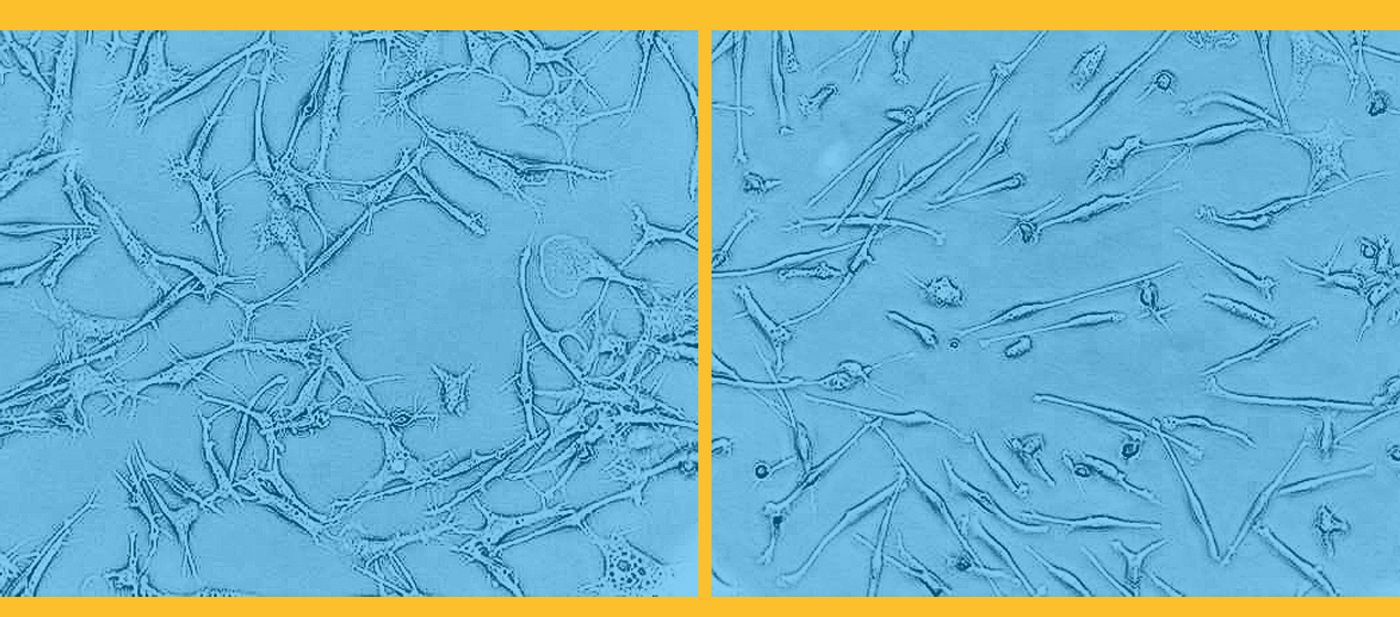 Macrophages before (left) and after (right) stimulation. Credit: Kaur Alasoo, University of Tartu