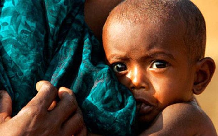 In 2017, roughly 151 million children younger than 5 were too short for their age due to malnutrition. Photo: India Today