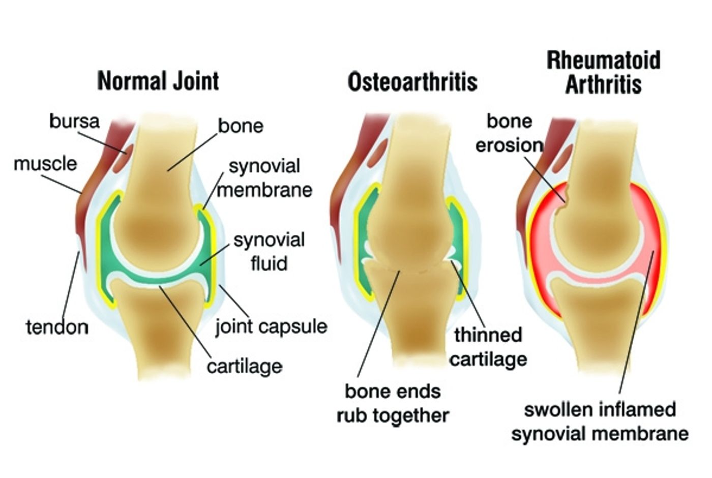 Credit: Practical Pain Management