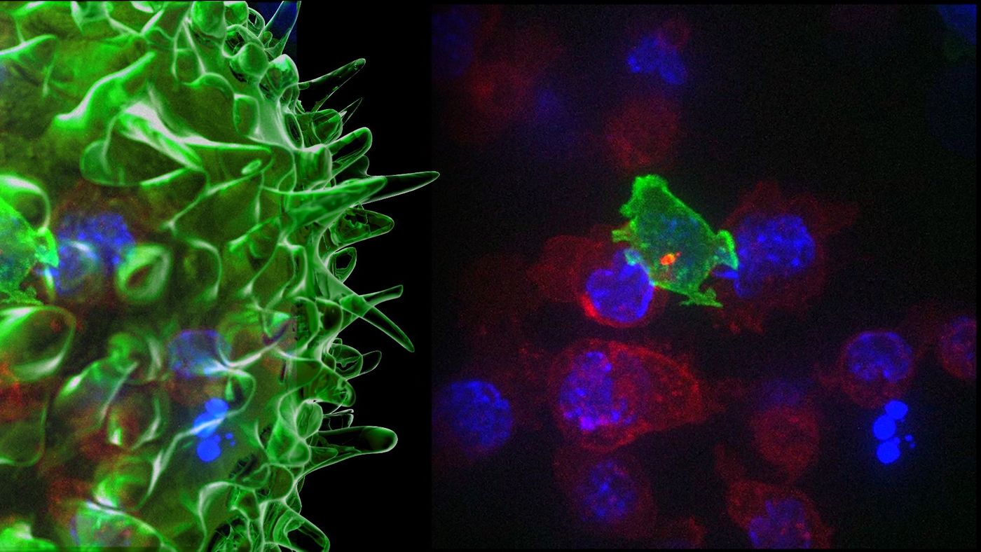 The Cytotoxic T Cell AKA The "Cancer Assassin." Credit: University of Cambridge