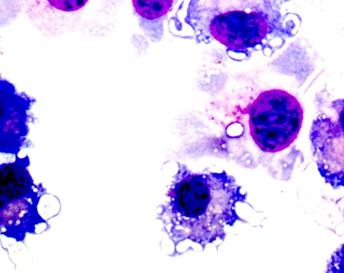MDSCs suppress the tumor-specific immune response. Credit: Dr. Alexandra Sevko, German Cancer Research Center