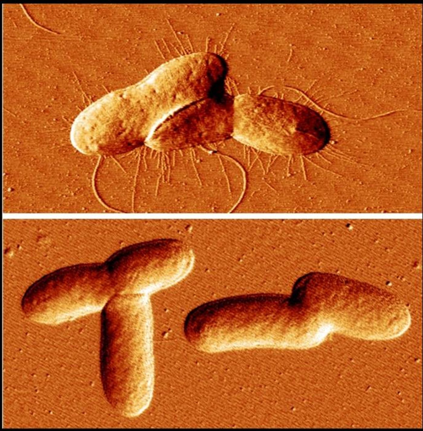 Microscopy images of bacteria strains, one, top, producing fimbriae as normal and one with high level of MEcPP unable to produce the fimbriae.   Credit  Jingzhe Guo/UCR