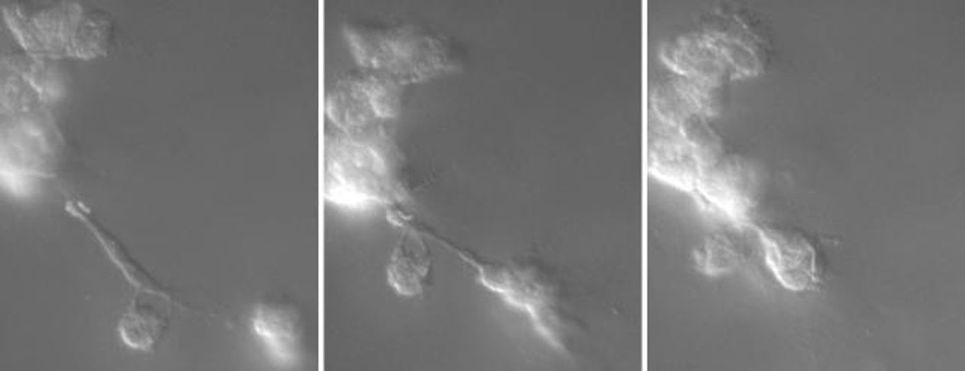 Melanoma cells move quickly, extending cables to reel in other cells and form tumors. The panels show how individual melanoma cells came together to build a tumor in just four hours. / Credit: David Soll laboratory, University of Iowa