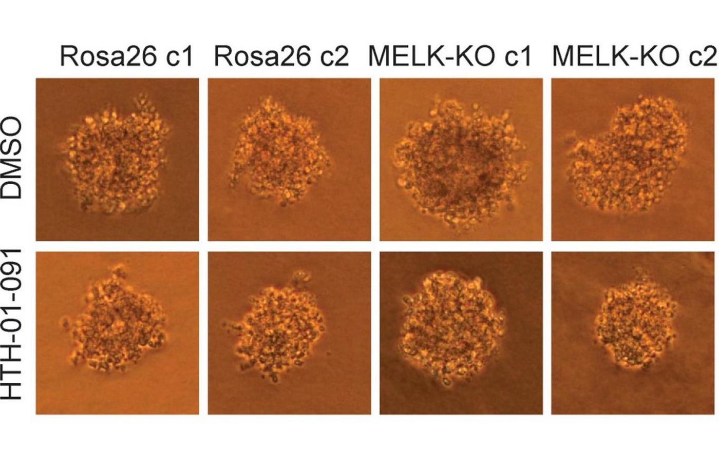 The growth of human colon cancer cells (raised in culture) is unaffected by the MELK gene. Top row: untreated cells; bottom row: cells treated with a MELK inhibitor drug. Left two columns, control cells; right two columns, cells in which MELK gene has been knocked out. CSHL researchers conclude that MELK is not involved in cancer proliferation.  / Credit: Sheltzer Lab, CSHL