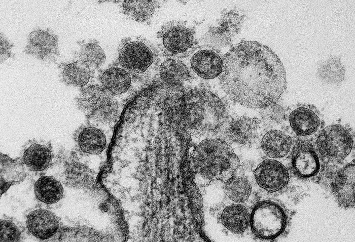 Transmission electron micrograph of Middle Eastern Respiratory Syndrome CoV particles found near the periphery of an infected MRC-5 cell. / Credit: NIAID
