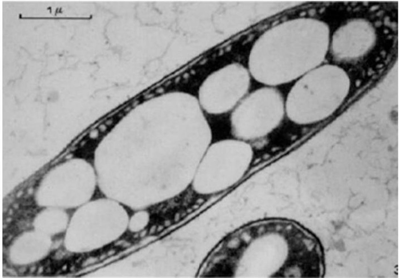 TEM image of a bacteria cell that has PHBV polymer "bubbles" (UNT Digital Library)