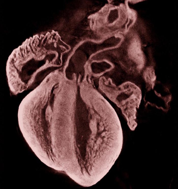 A frontal section of a mouse heart at embryonic day 17.5 showing normal anatomy, which can be disrupted by short-term exposure to hypoxia during gestation. The image was generated using optical projection tomography. / Credit: Company of Biologists