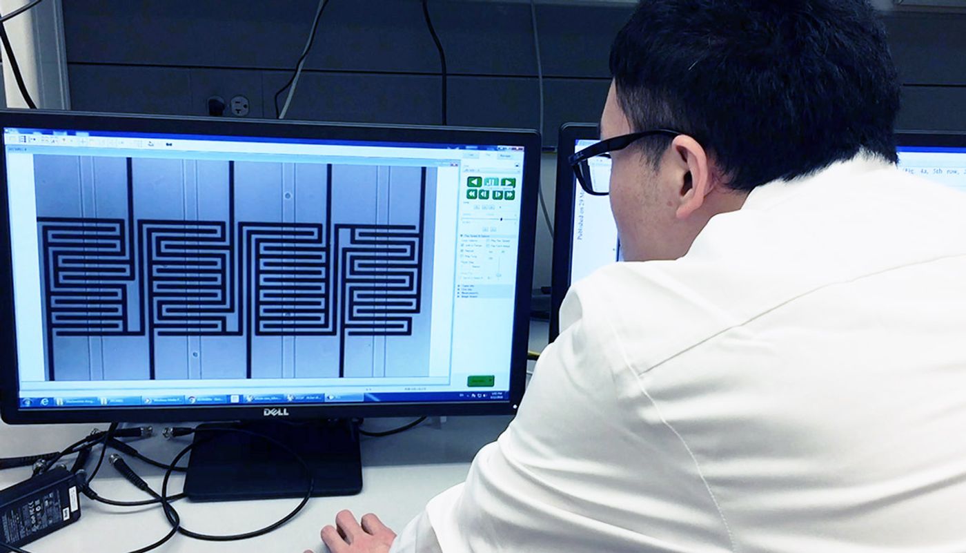 A researcher watches ovarian cancer cells move through a chip. The microfluidic channels are vertical; the circuit pattern is shown behind them.