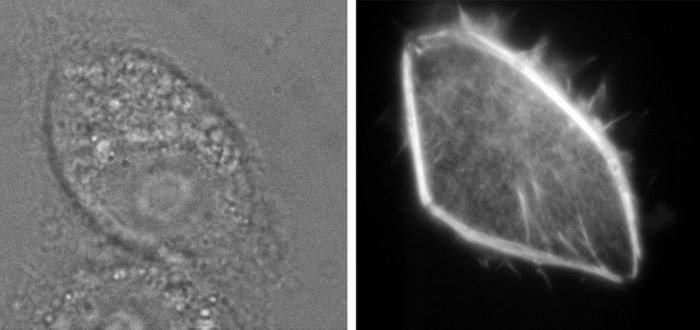A glass pipette injects fluorescent molecules into a kidney cell (left photo). A few seconds later, the molecules light up revealing new details (right photo). / CREDIT Photo: Bielefeld University