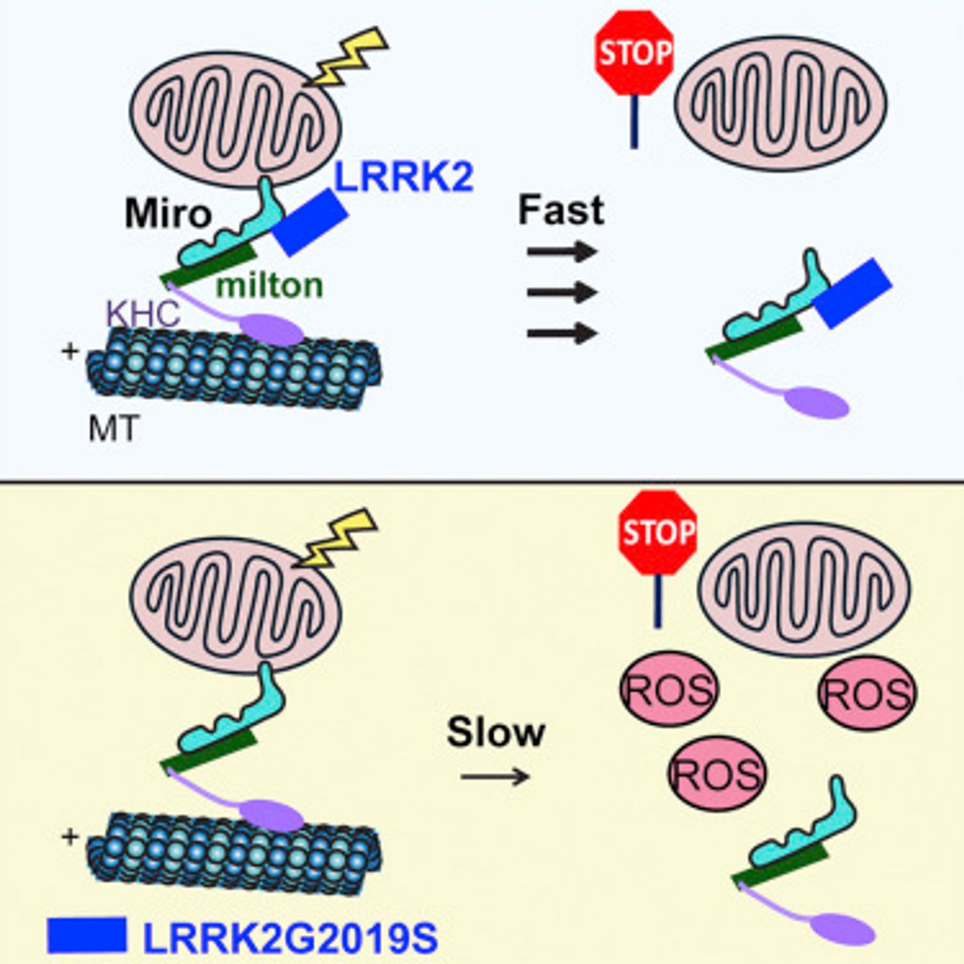 Graphical abstract shows Miro is an outer mitochondrial membrane protein that anchors mitochondria to microtubule motors and is removed to stop mitochondrial motility as an early step in the clearance of dysfunctional mitochondria LRRK2, promotes Miro removal by forming a complex with Miro. Pathogenic LRRK2G2019S disrupts this function, delaying the arrest of damaged mitochondria. / Credit: Cell Stem Cell, Hsieh et al