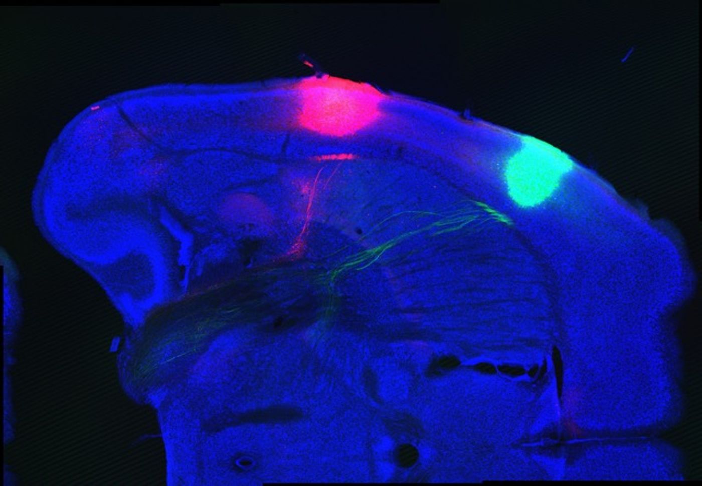 Taste areas found in the brain