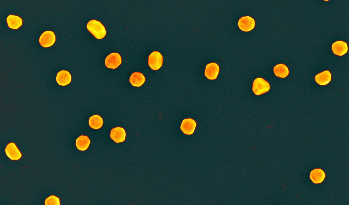 False color scanning electron micrograph (250,000 times magnification) showing the gold nanoparticles created by NIST and the National Cancer Institute's Nanotechnology Characterization Laboratory (NCL) for use as reference standards in biomedical research laboratories. / Credit: Andras Vladar, NIST