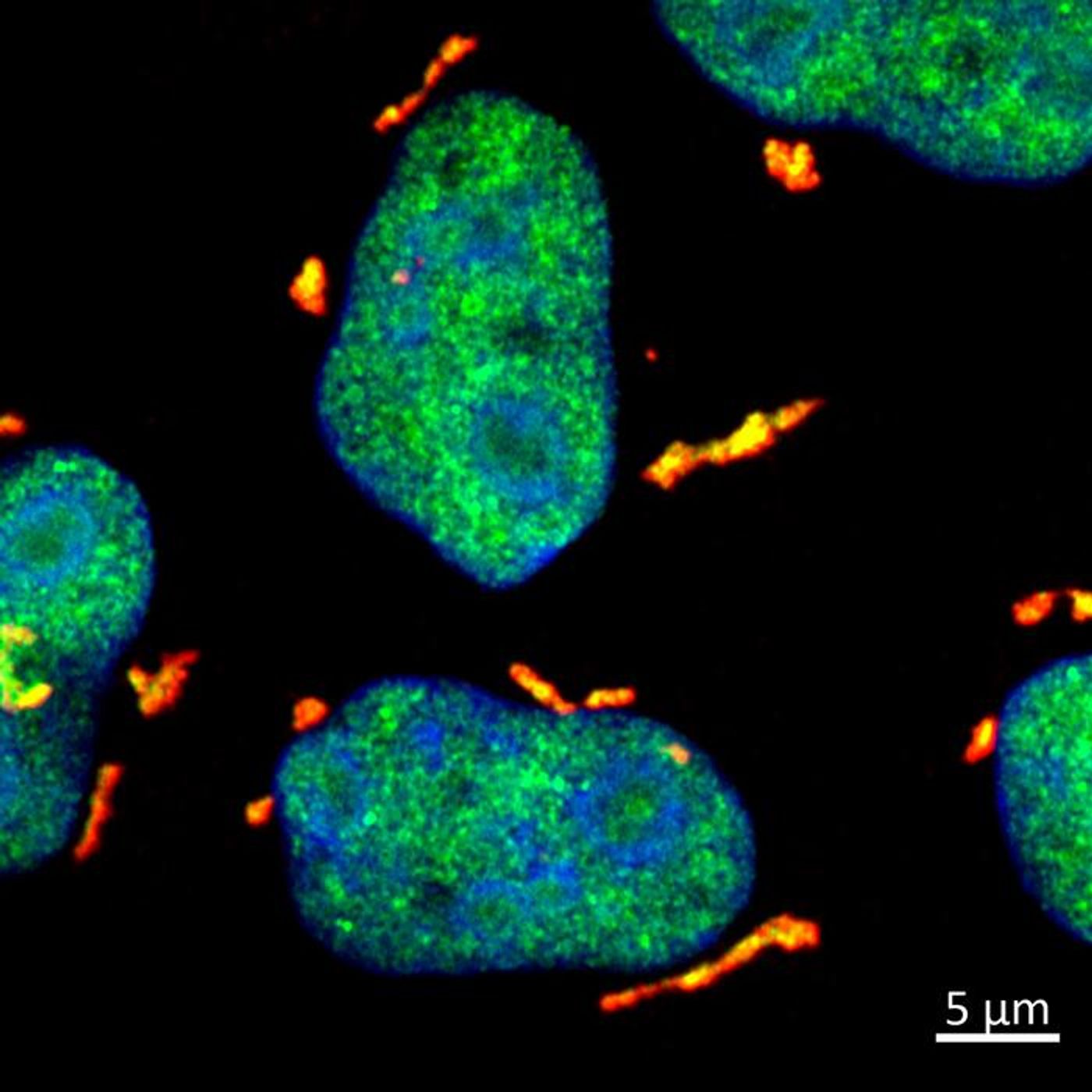After UV-induced RNA damage in HeLa cells, DHX9 (green) and G3BP1 (red) form stress granules in the cytoplasm. Cell nuclei are blue. / Credit: © MPI of Immunobiology and Epigenetics, Akhtar