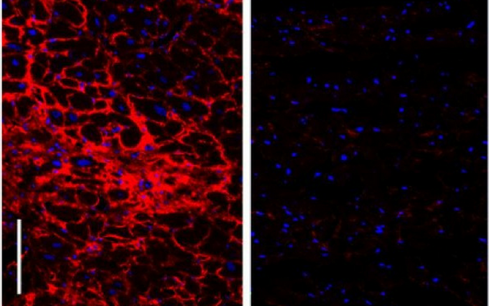 Chondroitin sulfate (marked in red), virtually absent in healthy human heart tissue (right panel), is found to accumulate in hearts of patients with heart failure, forming dense 'molecular nets' around the heart muscle cells (left panel). Credit: NUHS