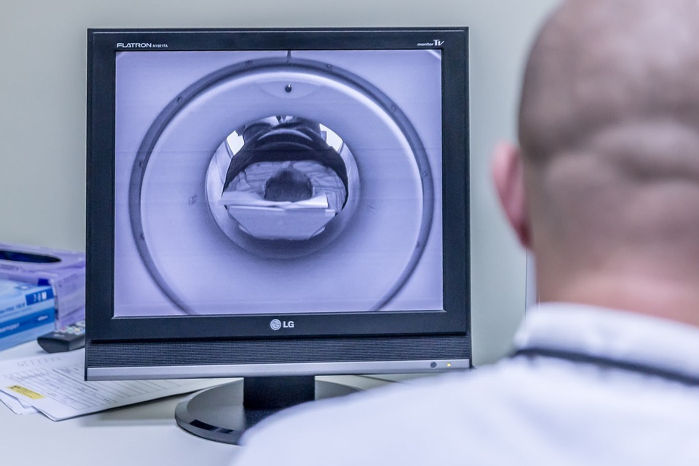 A new ultra-high-strength MRI was approved by the FDA in 2017.