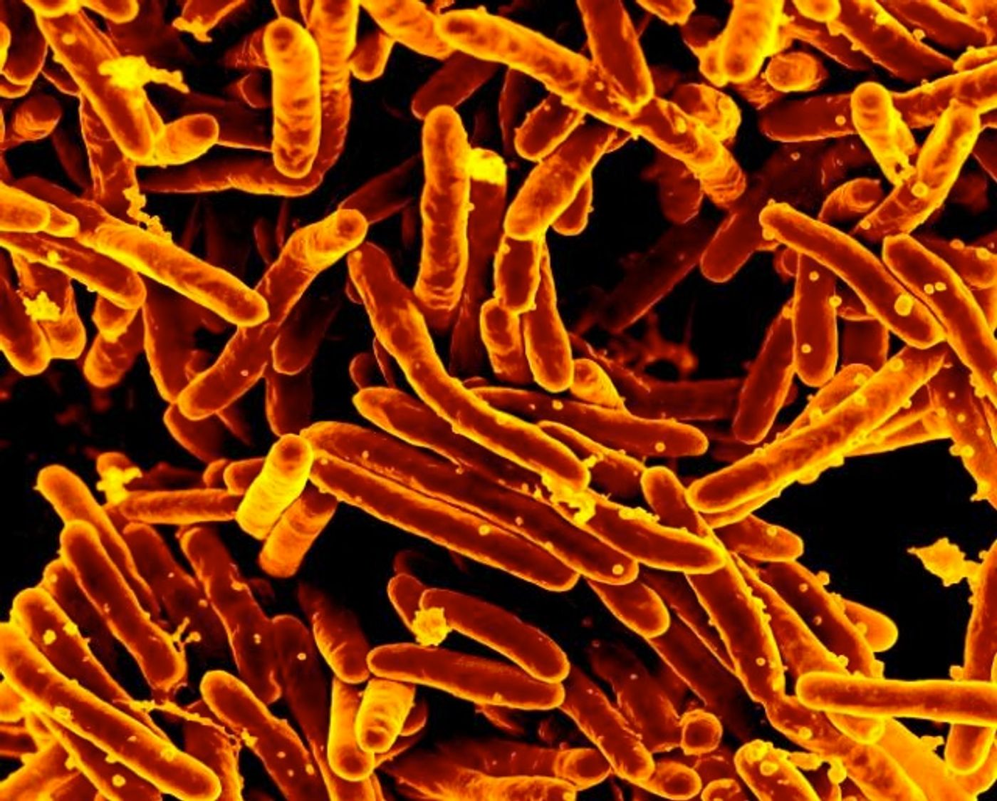 Myxobacterium tuberculosis, a bacterial strain associated with chronic infection / Credit: NIAID