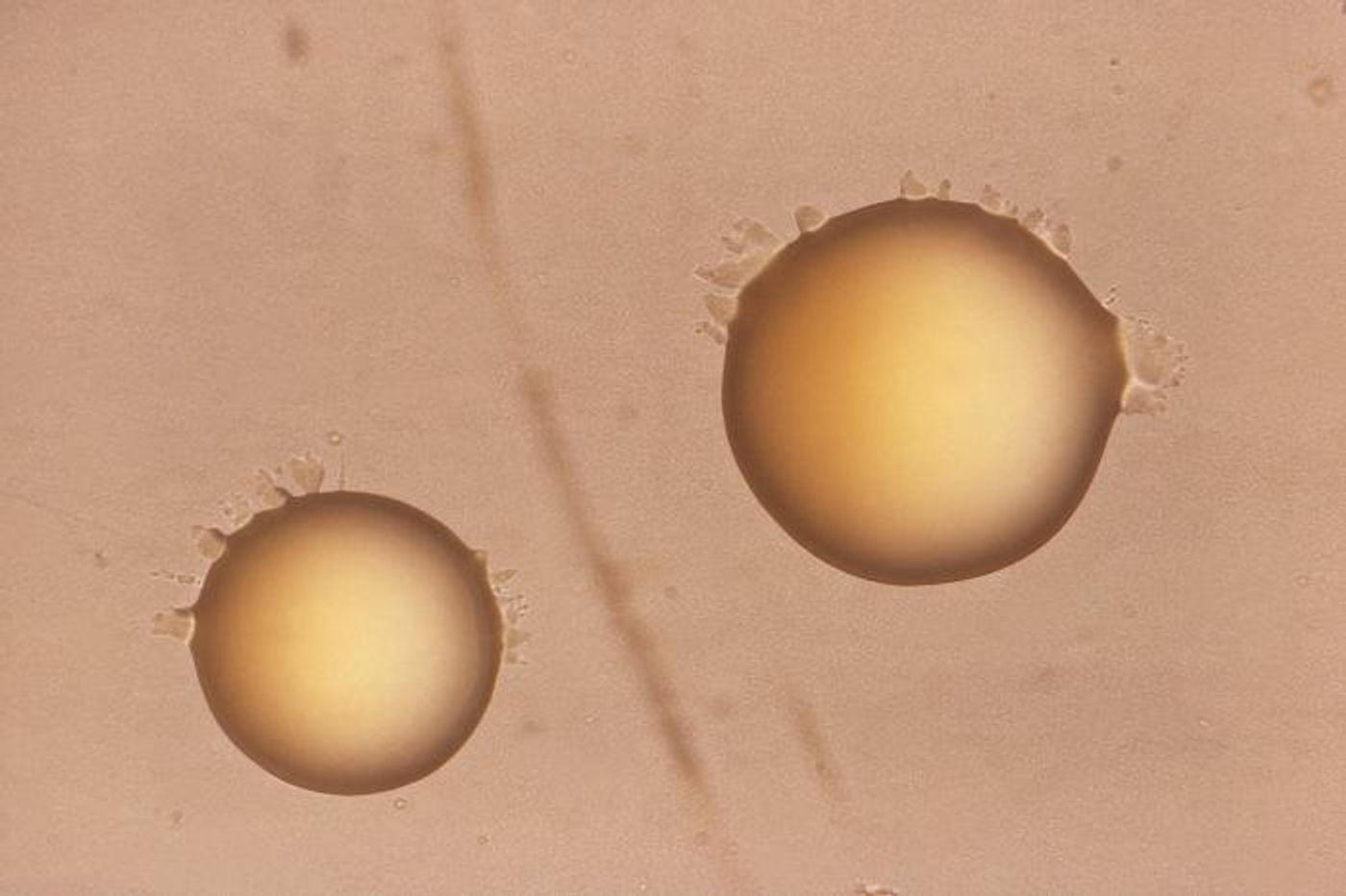 Two smooth, chromogenic colonies of Mycobacteria bacterial organisms / Credit: CDC/ Annie L. Vestal