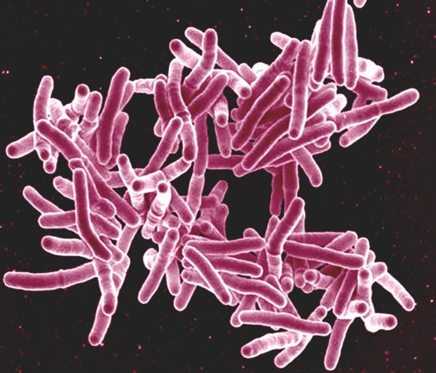 Mycobacterium tuberculosis Bacteria, the Cause of TB  Scanning electron micrograph of Mycobacterium tuberculosis bacteria, which cause TB. / Credit: NIAID