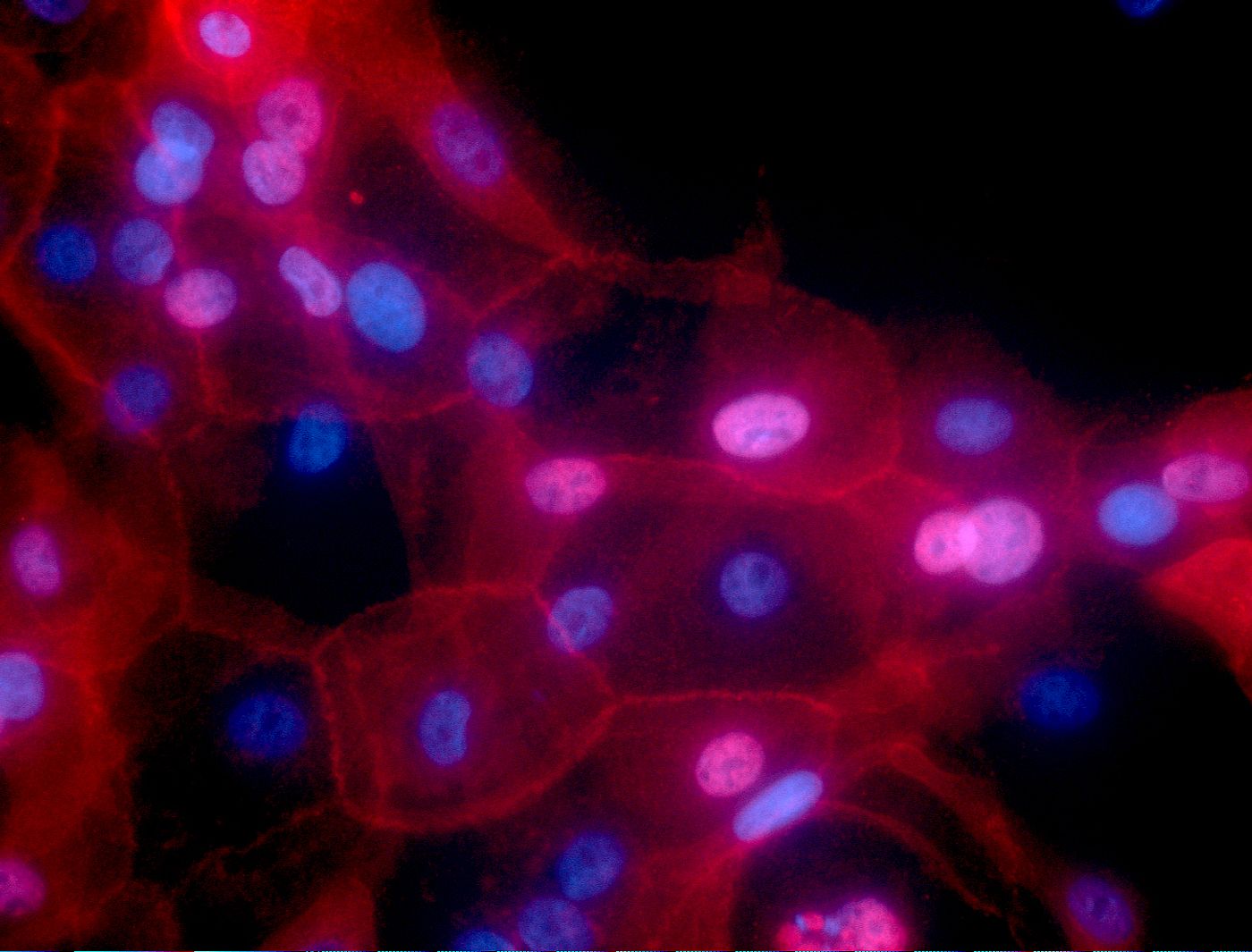 Image of human breast cancer conditionally reprogrammed cells in culture. Fluorescence red color represents MHC-I, and nuclei are shown in blue. / Credit: National Cancer Institute / Georgetown Lombardi Comprehensive Cancer Center / Ewa Krawczyk