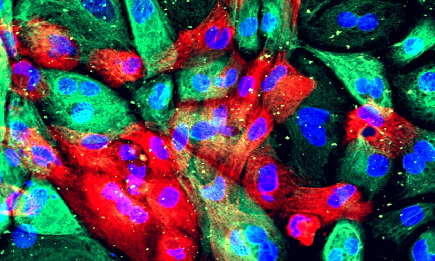 Wild type human prostate cells from an organoid  / Credit: National Institutes of Health
