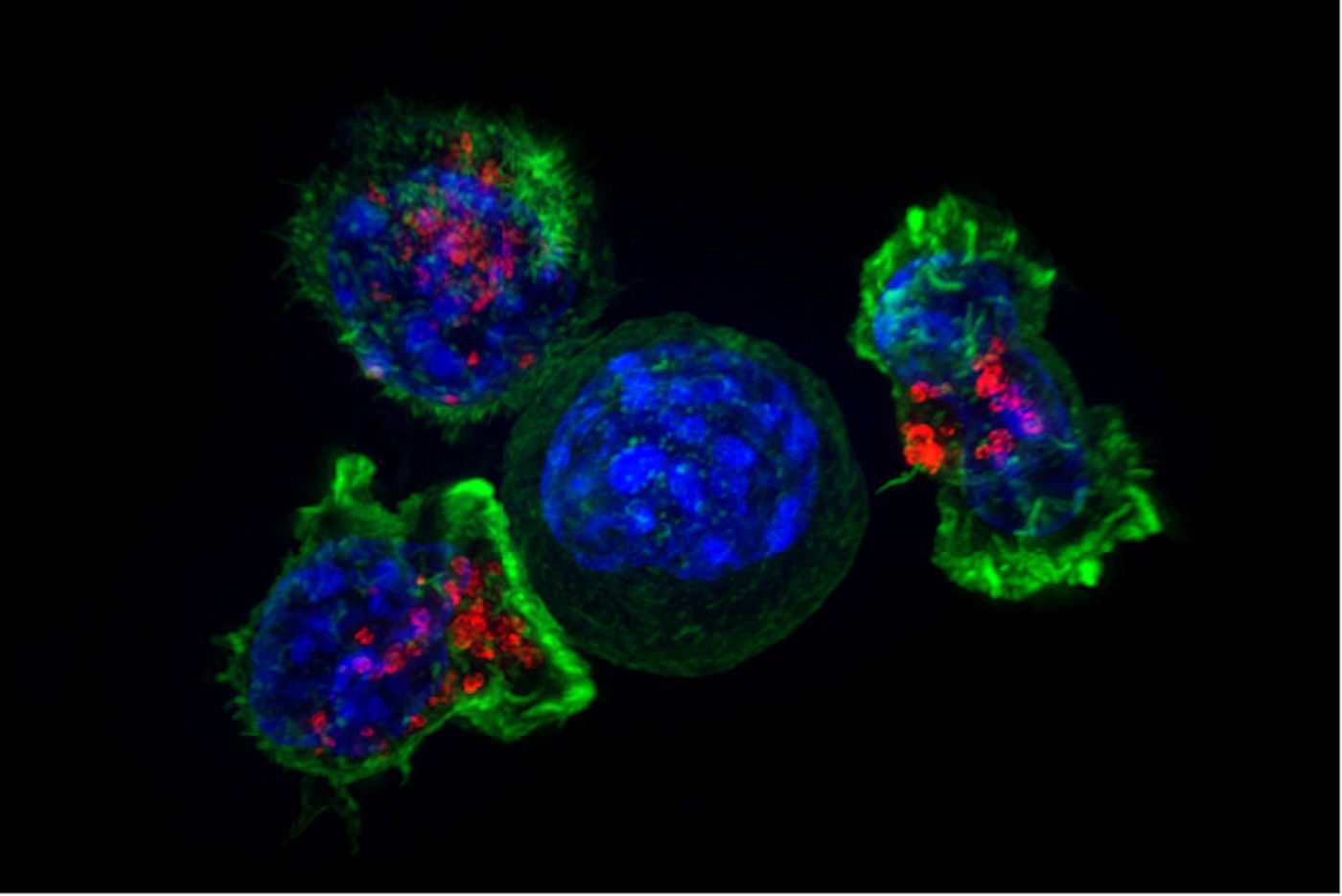 A group of killer T cells (green and red) surround a cancer cell (blue, center) / Credit: National Institutes of Health/NCI/Alex Ritter, Jennifer Lippincott Schwartz, and Gillian Griffiths
