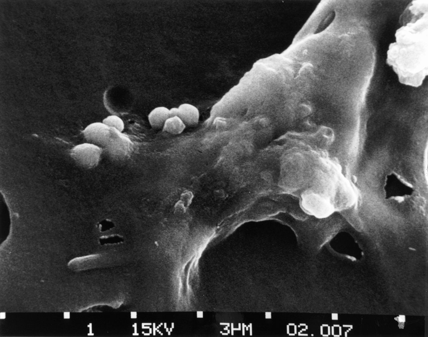 NCI Visuals Online; Source: Dr. Raowf Guirguis, National Cancer Institute; Creator: Susan Arnold