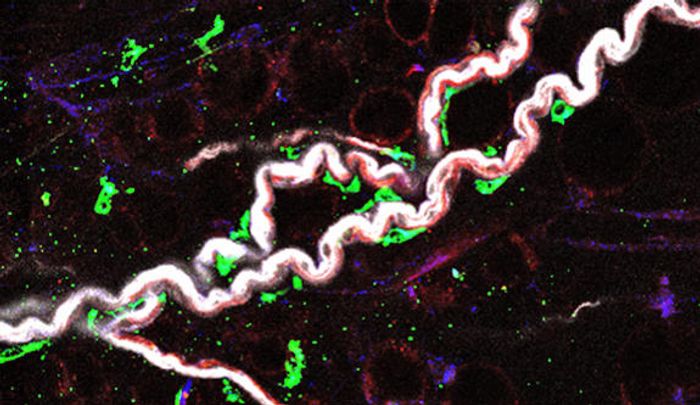 Nerve-associated macrophages (in green) hug the sympathetic nerves (in white) in visceral adipose tissue.