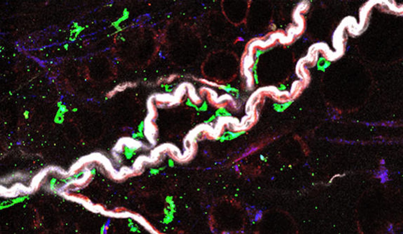 Nerve-associated macrophages (in green) hug the sympathetic nerves (in white) in visceral adipose tissue.