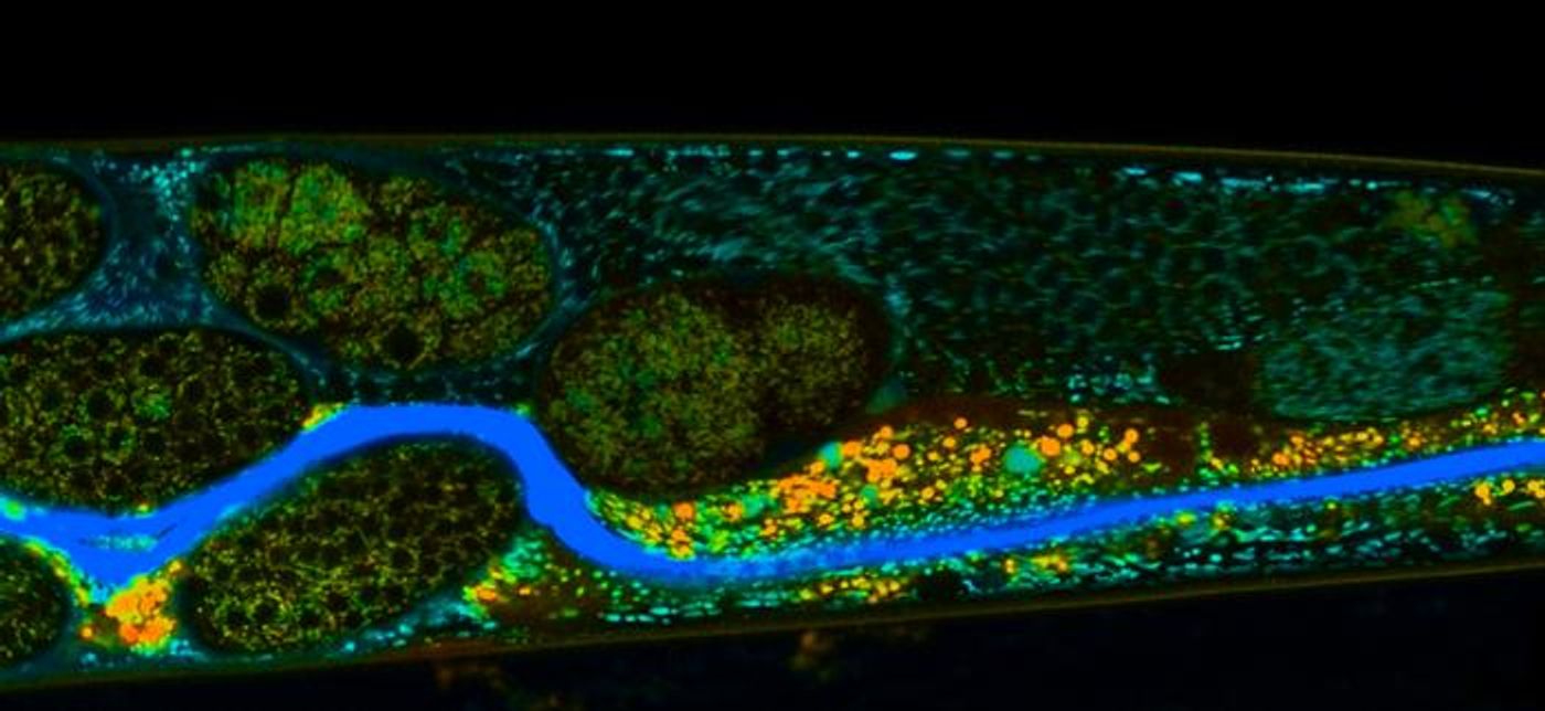 A magnified portion of Caenorhabditis elegans intestine, enriched with malpinins, imaged with fluorescence-lifetime imaging microscopy (FLIM) / Credit: Constanze Schultz/Leibniz Institute of Photonic Technology