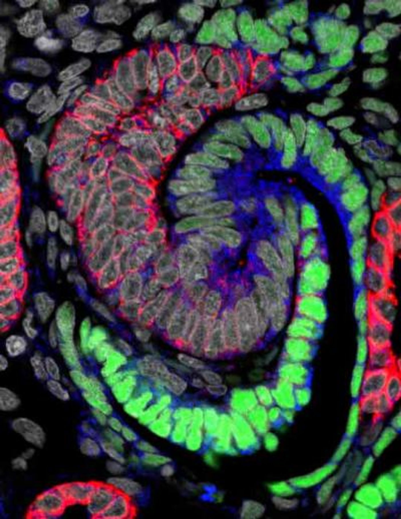 At an early stage, a nephron forming in the human kidney generates an S-shaped structure. Green cells will generate the kidneys' filtering device, and blue and red cells specialized regions responsible for distinct nephron activities. / Credit: Image courtesy of Stacy Moroz and Tracy Tran/Andy McMahon Lab, USC Stem Cell