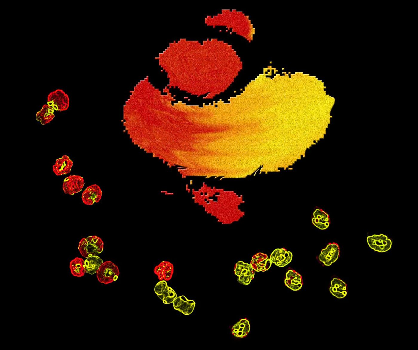 The top left cells represent neutrophil progenitors and the right bottom ones are fully differentiated neutrophils. The color of nucleus matches the color on the viSNE map in the middle, where red indicates higher in the hematopoietic hierarchy and yellow indicates lower. / Credit: Dr. Yanfang Peipei Zhu, La Jolla Institute for Allergy and Immunology