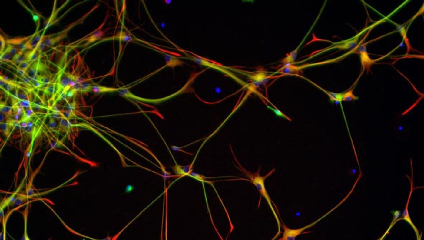 Neural stem cells give rise to neurons, which are the cells which make up the nervous system including the brain.