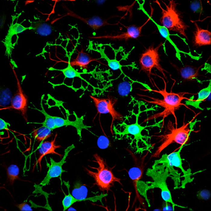 Neural stem cells (NSCs) help reverse damage caused to brain cells, are repressed during progression of Alzheimer's.