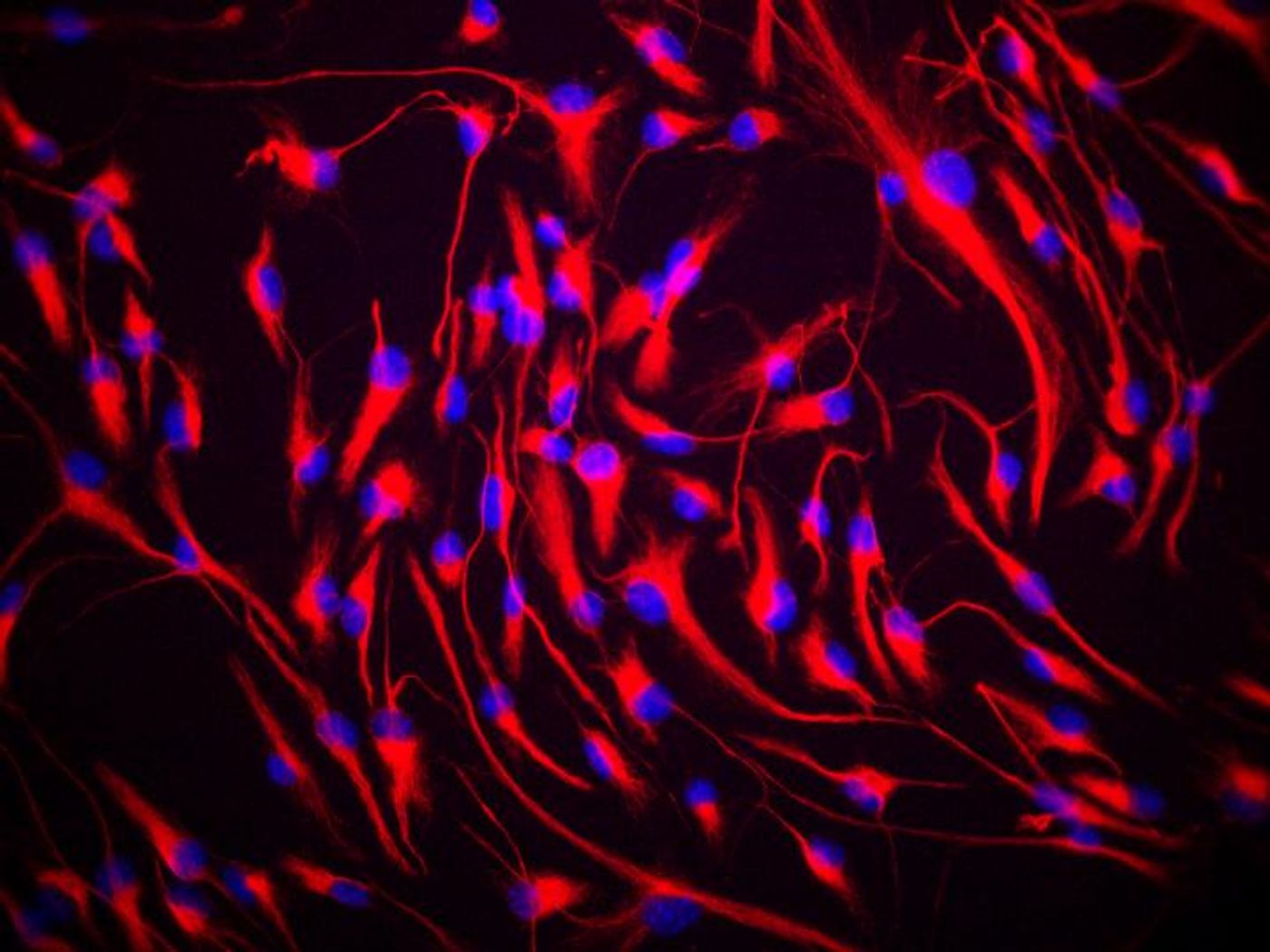 These are stem cells from the brain. Cells were labelled using a stain that detects a protein called nestin, found in neural stem cells. / Credit: Dr. Giuseppe Lupo