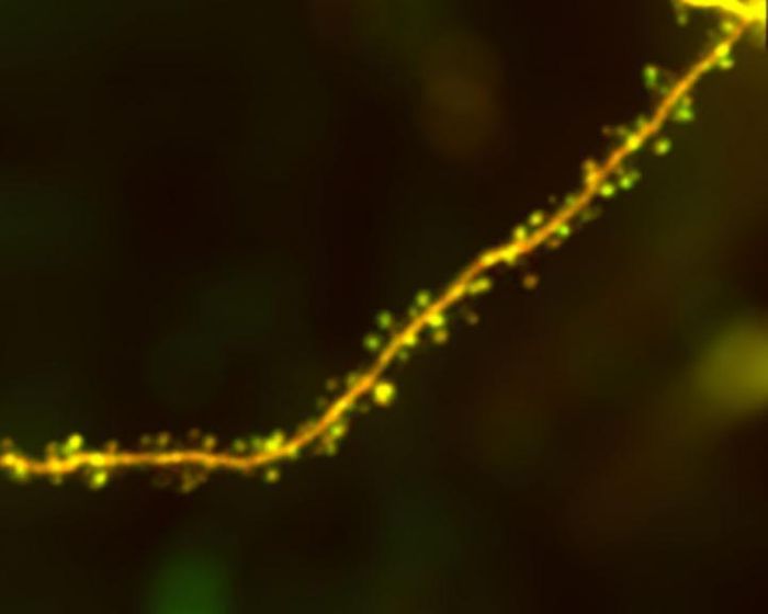 Image of a dendrite (a branch of a neuron) with round processes or spines, expressing a red fluorescent protein together with a green tag for the protein Arc, obtained with two-photon microscopy in an awake mouse. / Credit: Sur, et. al.